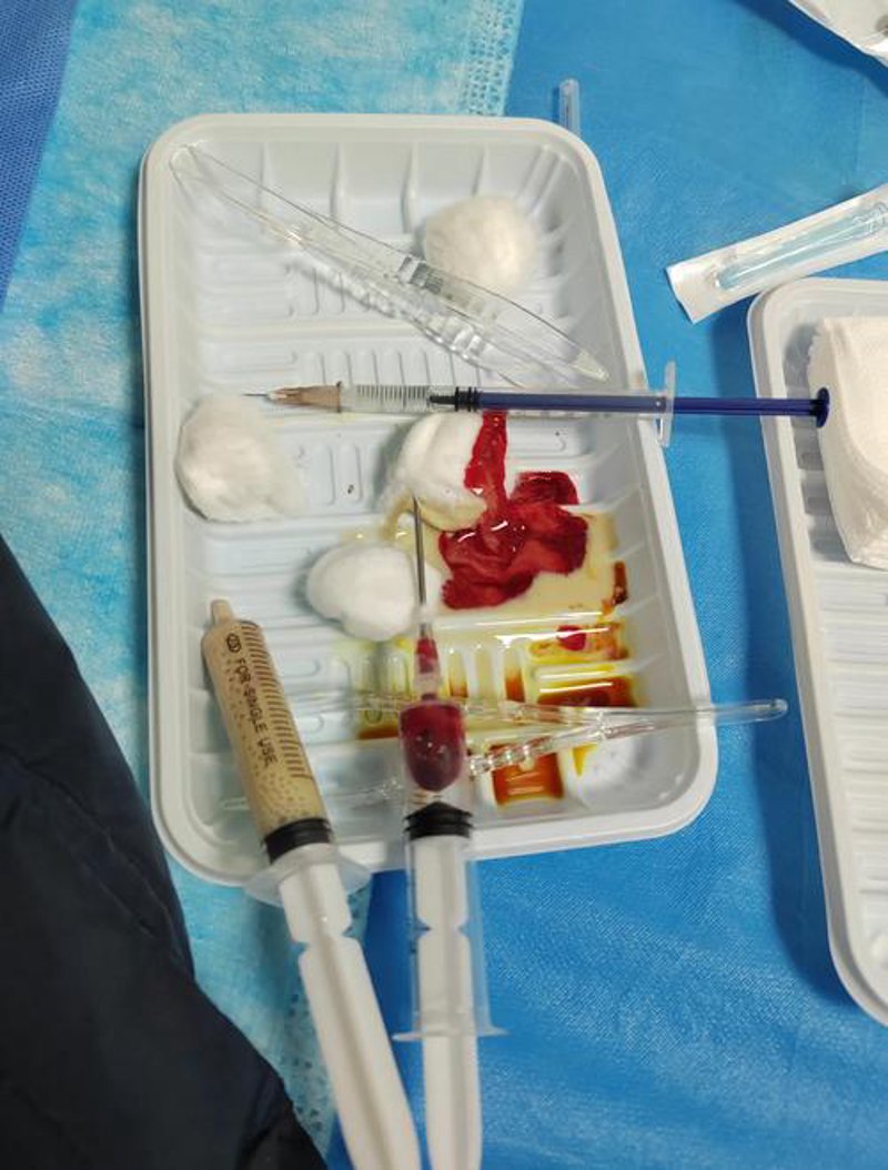 乳腺健康误区警示:选对济南乳腺病医院是关键